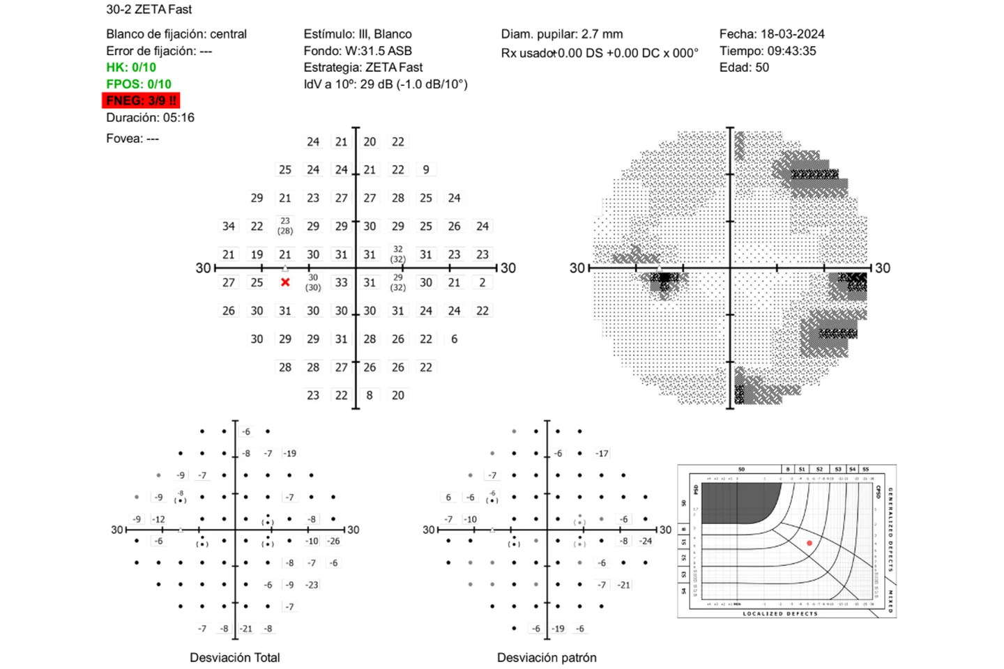 Ejemplo visual autorizado de un campo visual computarizado 30-2 con estrategia ZETA Fast